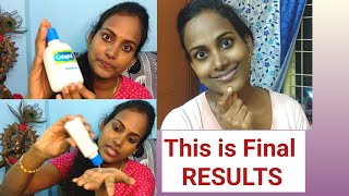 Cetaphil Gentle Skin Cleanser Review amp Demo in Telugu  Best Face wash for Dry amp Sensitive skin [upl. by Naesed973]