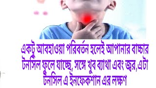 Discussion of Tonsillitisটনসিল এ ইনফেকশনCauses Homeopathic Treatment amp How to prevent it [upl. by Annalee]