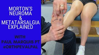 Mortons Neuroma and Metatarsalgia Whats the Difference [upl. by Essile]