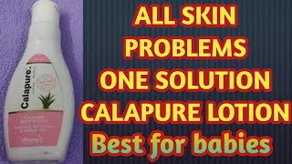 Best lotion for soften skin moisturizer Calapure lotion uses and reviews [upl. by Tamanaha]