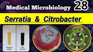 Serratia amp Citrobacter Late lactose Coliforms شرح بالعربي [upl. by Leanatan276]