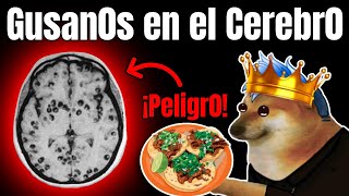 EL PELIGR0 DE COMER TAQUITOS EN LA CALLE  La neurocisticercosis [upl. by Haissem]