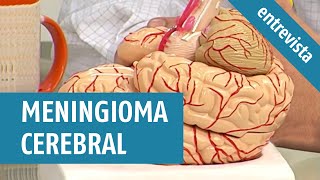 MENINGIOMA CEREBRAL um dos tumores cerebrais mais comuns [upl. by Zaid]