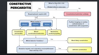 Constrictive Pericarditis signs in a case [upl. by Ulane]