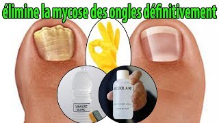 élimine la mycose des ongles définitivement  conseils [upl. by Thorley956]