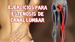 Ejercicios para ESTENOSIS DE CANAL LUMBAR [upl. by Rooke]