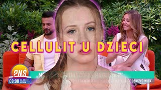 Jak zwalczyć cellulit u 5latki czyli Pytanie na śniadanie w formie [upl. by Tessy]