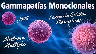 Gammapatías Monoclonales Explicadas Claramente [upl. by Aneetak]