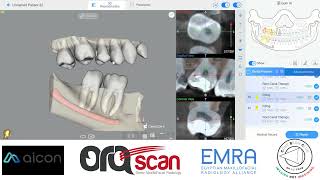 Notes for AI in Dentistry [upl. by Gonsalve]