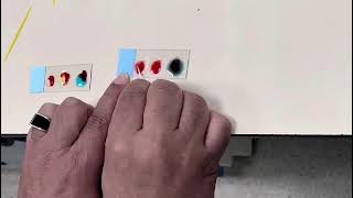 Determination of Blood Groups By Prof Dr Mohammad Yosof [upl. by Anaicul305]