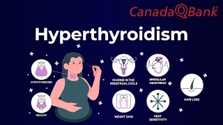 Hyperthyroidism [upl. by Turnheim523]