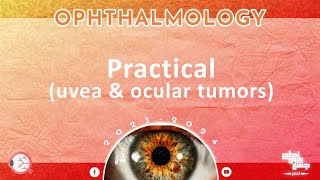 Pract Uveal tract disorders and ocular tumors Ophthalmology [upl. by Rehptsirhc]