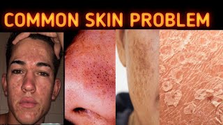 Top common Skin Problem solutionbeautytips facecareroutine [upl. by Prosperus]