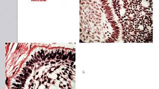 Odontogenic Tumors [upl. by Aicinod44]