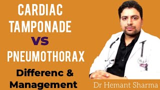 Cardiac Tamponade vs Tension Pneumothorax difference and How to do management [upl. by Yelhs235]