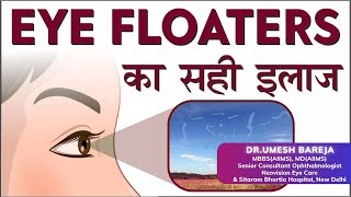 Eye Floaters  Cause amp Treatment  Risks amp Management of Floaters  Dr Umesh Bareja  Eye Specialist [upl. by Desberg858]