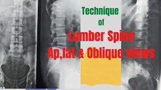 Technique of L Spine Ap  Lat amp Oblique views Ep63 Xray lumber spine views [upl. by Aifas]