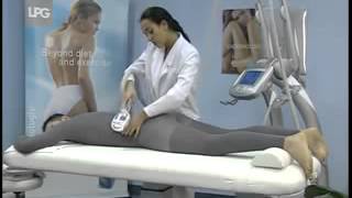 LPG Endermologie treatment demo  Salon House  London [upl. by Llenrup]