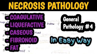 Necrosis Pathology  Types of Necrosis  Cell injury pathology  General Pathology 4 [upl. by Suoiradal216]