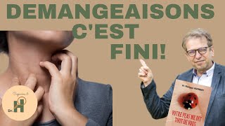 Comment en finir avec les démangeaisons Conseils dun dermatologue [upl. by Phi]