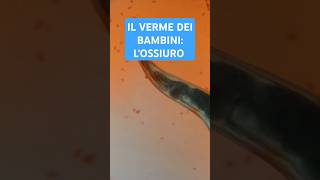 I VERMI dei BAMBINI gli OSSIURI prevenzione biologia [upl. by Jemina]