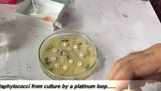 Coagulase positive test  Staphylococcus aureus [upl. by Byran]