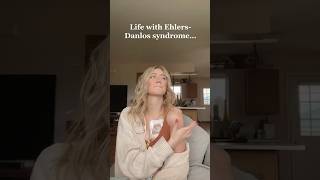 EhlersDanlos Syndrome [upl. by Beffrey]