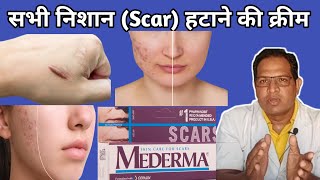 mederma cream  Mederma for acne scars  Mederma Advanced scar gel review [upl. by Wenn]