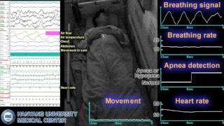 Noncontact Sleep Monitoring Somnography Using an IR UWB Radar Sensor August 2016 [upl. by Aliuqa507]