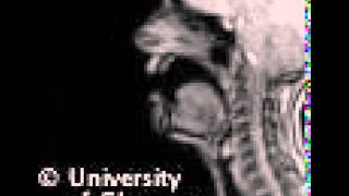 MRI voiceless bilabial plosive [upl. by Layman]