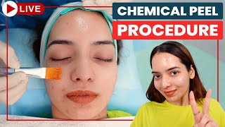 CHEMICAL PEELS Step by Step  Acne Scar Treatment in Delhi  Chemical Peeling Treatment Dr Jangid [upl. by Noell]