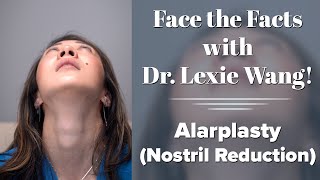 Alarplasty Nostril Reduction  Face the Facts with Dr Lexie Wang  West End Plastic Surgery [upl. by Aala]