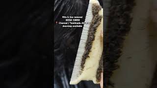 Nits lice treatment 💯 result Chennai amp doorstep available headlicetreatmentliceremovalnitslice [upl. by Amabelle924]