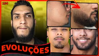 EVOLUÇÕES COM MINOXIDIL  RESULTADOS COM MINOXIDIL 134 [upl. by Silsby]