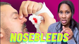 How to Stop a Nose Bleed A Doctor Explains [upl. by Plerre]