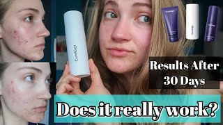 I Tried Curology For 30 Days NOT SPONSORED  Tracking The Results  Review [upl. by Reginauld251]