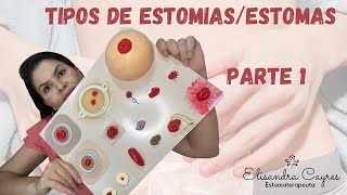 TIPOS DE ESTOMIAS OU ESTOMAS  ESTOMATERAPIA [upl. by Evelinn985]