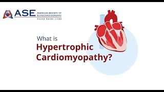 What is HCM and Who is at Risk for HCM [upl. by Ahtamas]