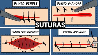 PUNTOS DE SUTURA QUIRURGICA SIMPLE SARNOFF SUBDERMICO Y ANCLADO sutura [upl. by Beverie]