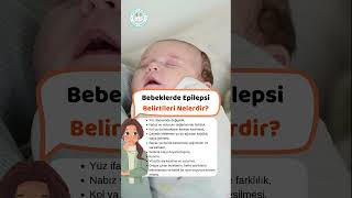 Bebeklerde Epilepsi Belirtileri Nelerdir [upl. by Kinna117]