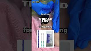 Thread Lift For Face Lifting [upl. by Keen]