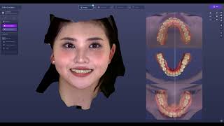 Digital Smile Design  Ortho Simulator  RAYFace workflow [upl. by Etteloiv]