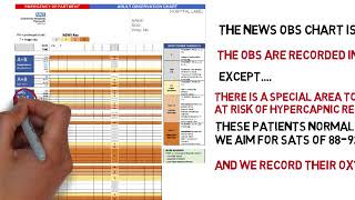 Video 2  Using the NEWs chart [upl. by Aramahs350]