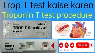 Trop T test kaise karen  Troponin T test procedure  Trop T blood test kaise kare [upl. by Ribble140]