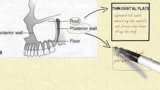 Anatomy of maxillary sinus [upl. by Drahcir]