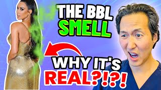 Plastic Surgeon Reacts to the BBL SMELL Why BBLs Stink [upl. by Noitsirhc]