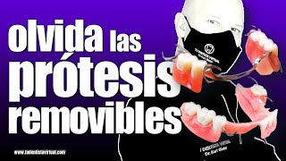 Le CAMBIAMOS sus PRÓTESIS REMOVIBLES por DIENTES FIJOS sin INJERTOS de HUESO en 3 DÍAS CASO REAL [upl. by Aihseyk655]