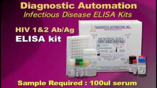 HIV1amp2 ELISA kit [upl. by Ventre]