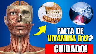 Nunca Ignore esses 10 Sintomas de Deficiência de Vitamina B12 [upl. by Colson317]