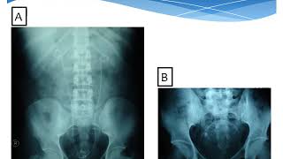 Urologic Investigations  urology  6th grade  Dr Islam Farouk [upl. by Haleelahk]